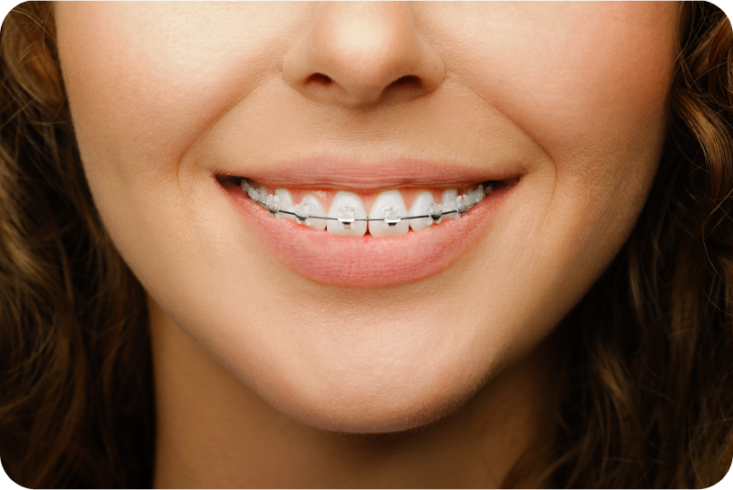 orthodontiste choisy le roi Orthodontiste à Choisy-le-Roi Dr Kévin MAHOUN - Orthodontiste à Rungis