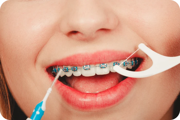 hygiene appareil dentaire orthodontiste orly Orthodontiste à Orly Dr Kévin MAHOUN - Orthodontiste à Rungis