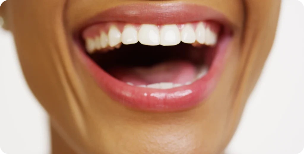 sourire aligne orthodontiste athis mons Orthodontiste à Athis-Mons Dr Kévin MAHOUN - Orthodontiste à Rungis