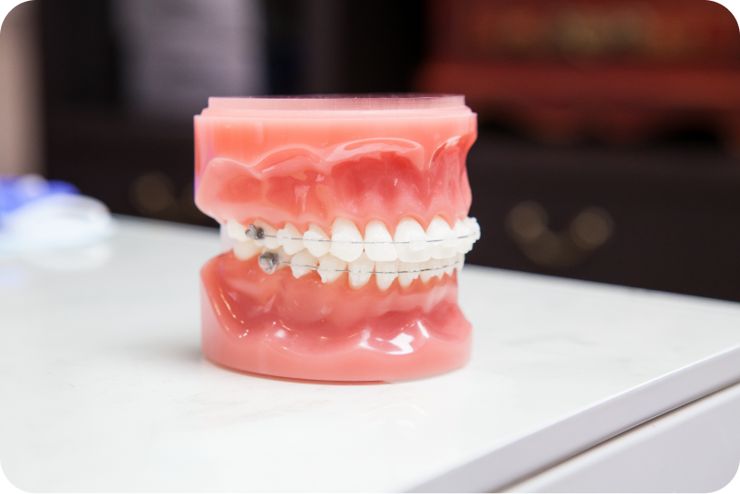 traitement orthodontique rungis Orthodontiste à Rungis Dr Kévin MAHOUN - Orthodontiste à Rungis